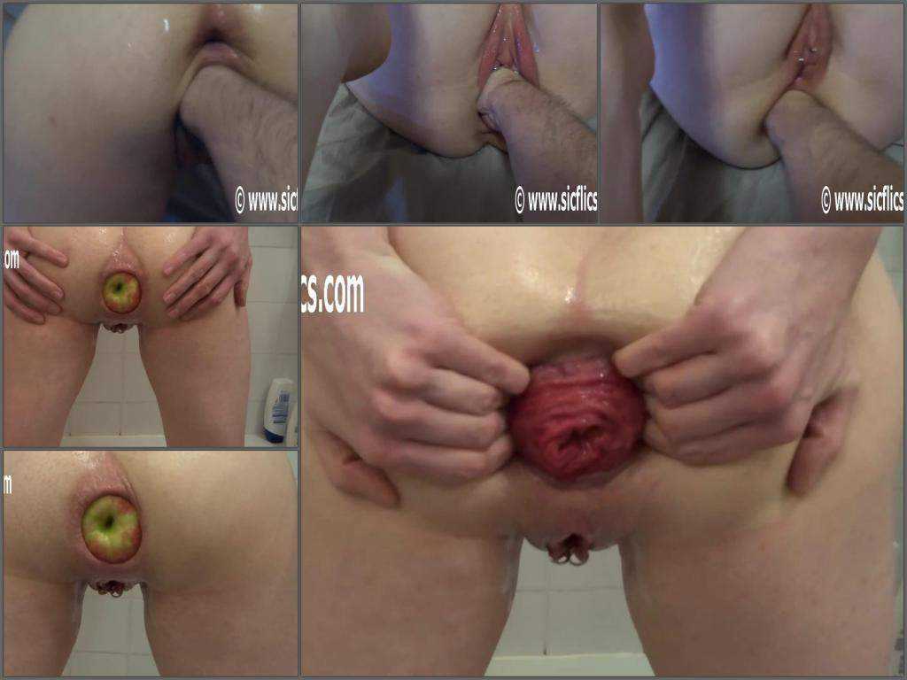Big apple deep penetration in shocking anal prolapse horny milf