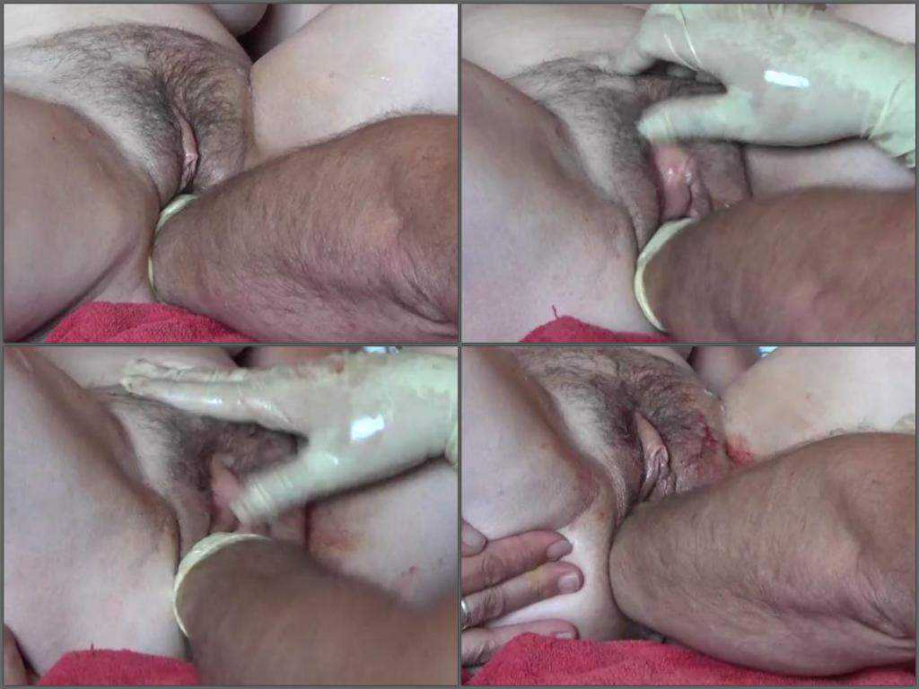 Hardcore bloody fisting with hairy wife homemade
