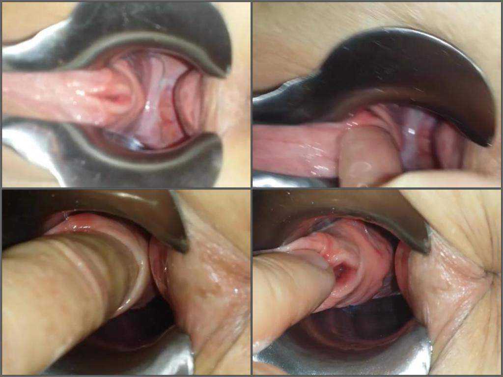 Husband penetrated finger into urethra his wife