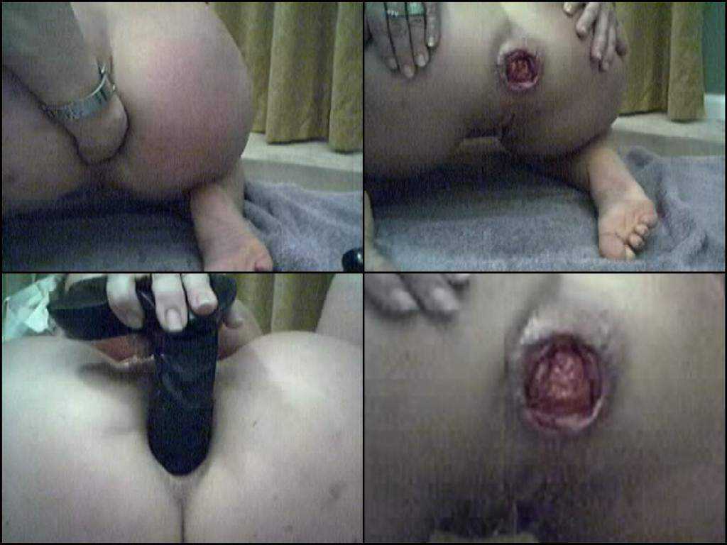 Amateur prolapse anal, fisting and dildo penetrated