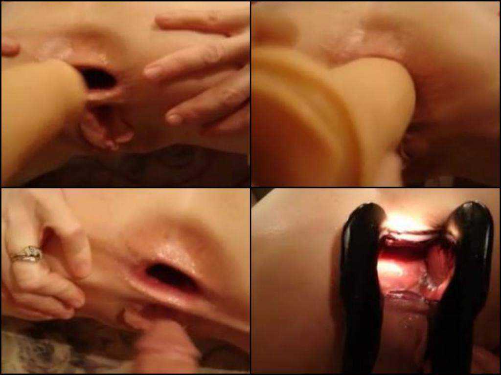 Speculum gaping anus and extreme double fisting wife