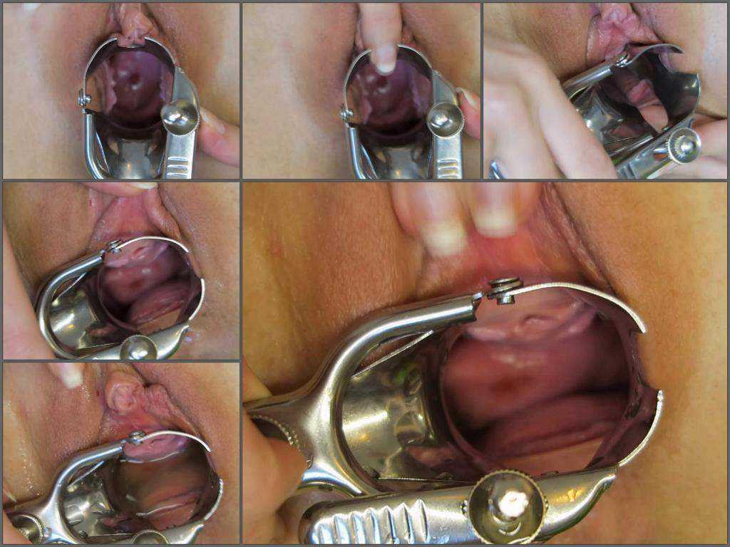 Unknown large labia girl speculum examination and peeing