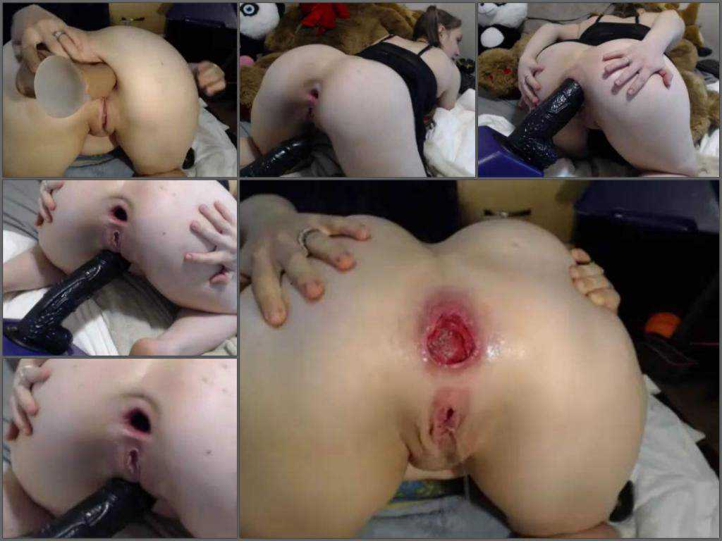 Webcam big ass girl insertion dildo in huge prolapse and gape