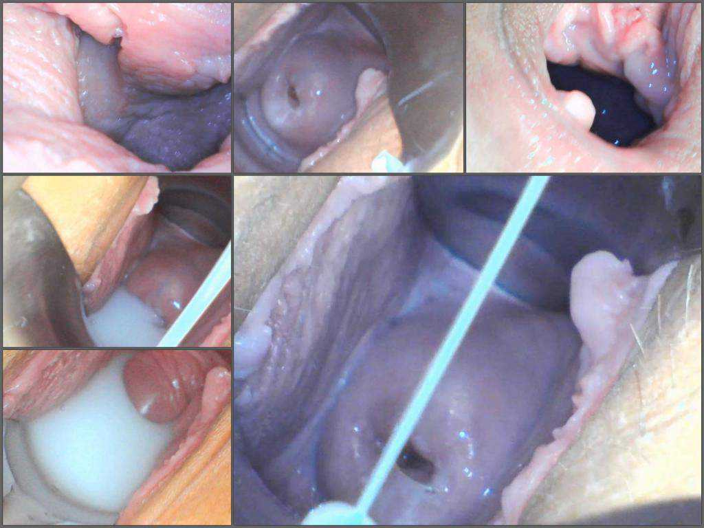 Urethral sounding – Milly17 covering my cervix in cumendo/stetho webcam show
