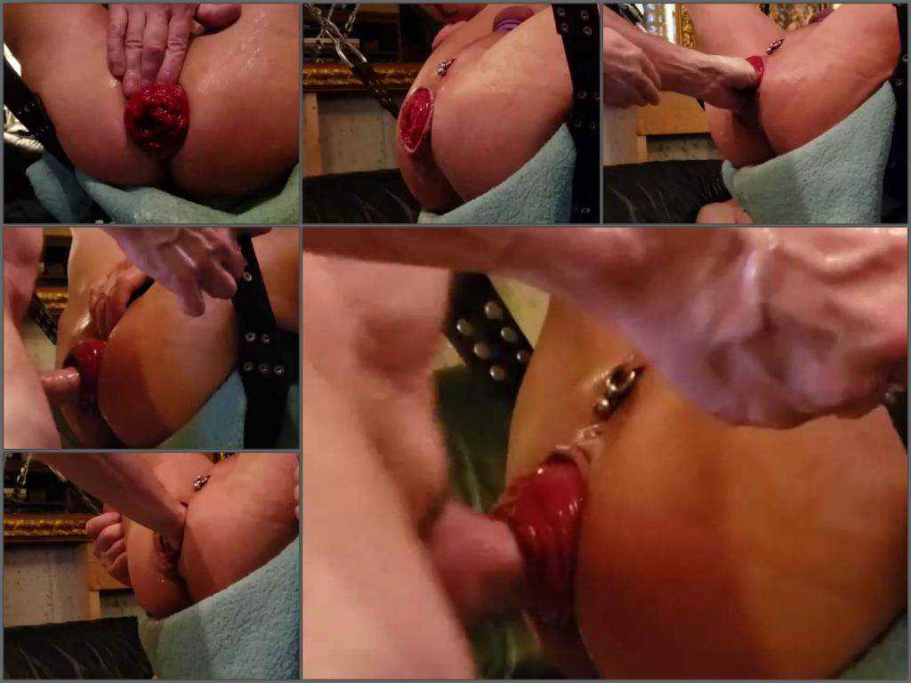 Gay fisting – Amateur amazing gays porn – fisted and fuck huge anal prolapse