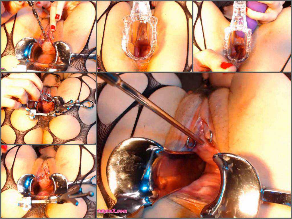 Speculum examination – Hairy girl AdalynnX sounding my cervix and peehole