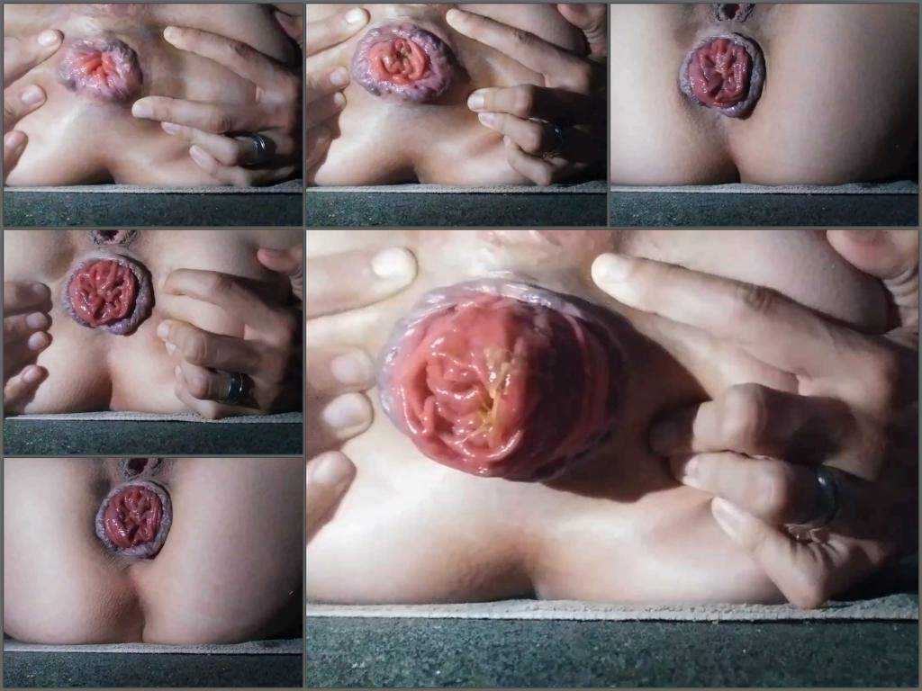 Prolapse porn – Very beautiful anal prolapse and rosebutt stretching closeup