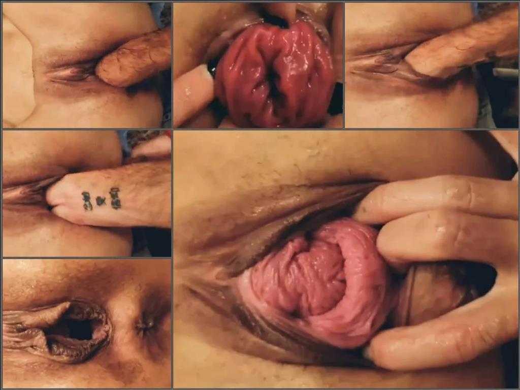 Pussy fisting – Amateur pussy and anal prolapse loose during hard fisting sex POV