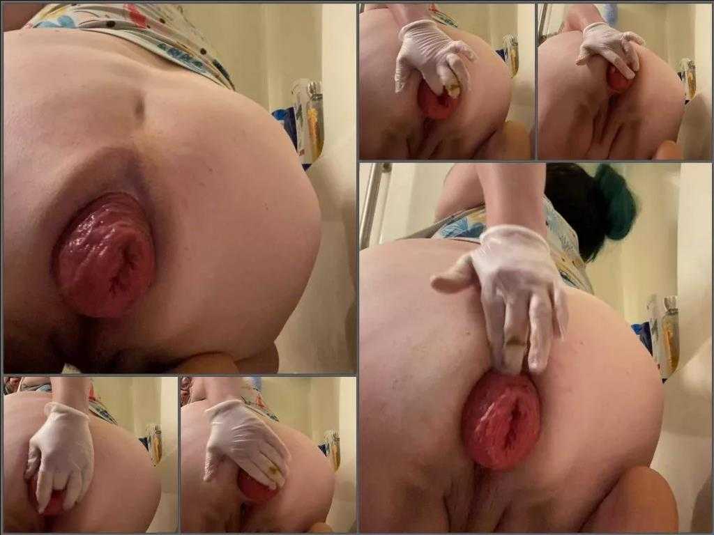 Anal Prolapse Perverted Porn Videos Page 4