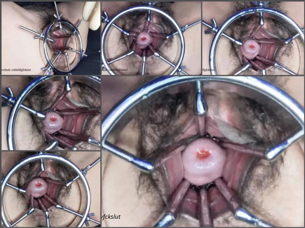 Hairy pussy – Huge cervix show during speculum examination very closeup