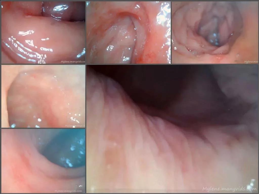 Medical Fetish – Anal depth endoscopy. Butthole explorer with russian girl – Premium user Request