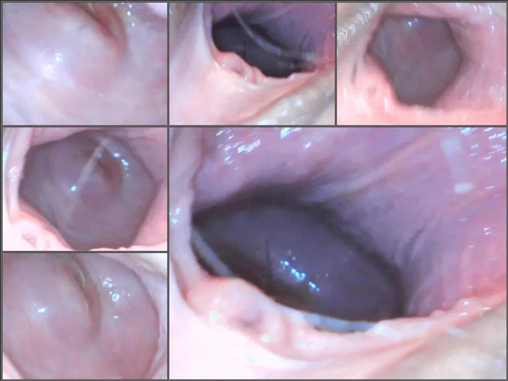 Webcam teen – Makinbiscuits Endoscope cervix exploration unique amateur