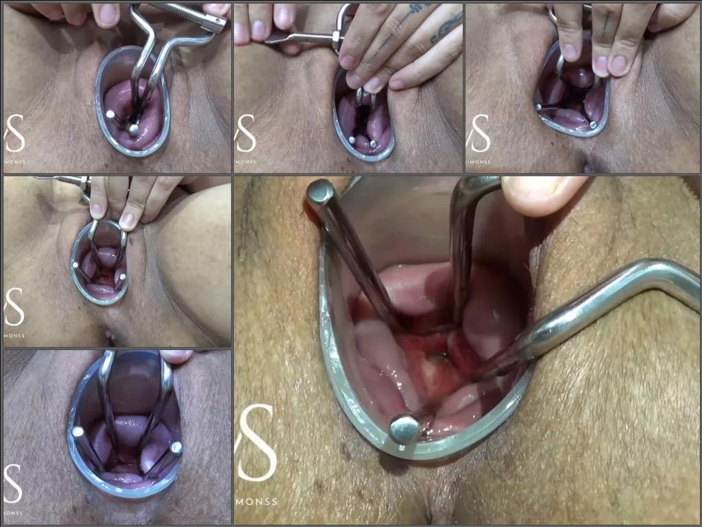 Amateur – Mayasimons opening her cervix extreme with speculum