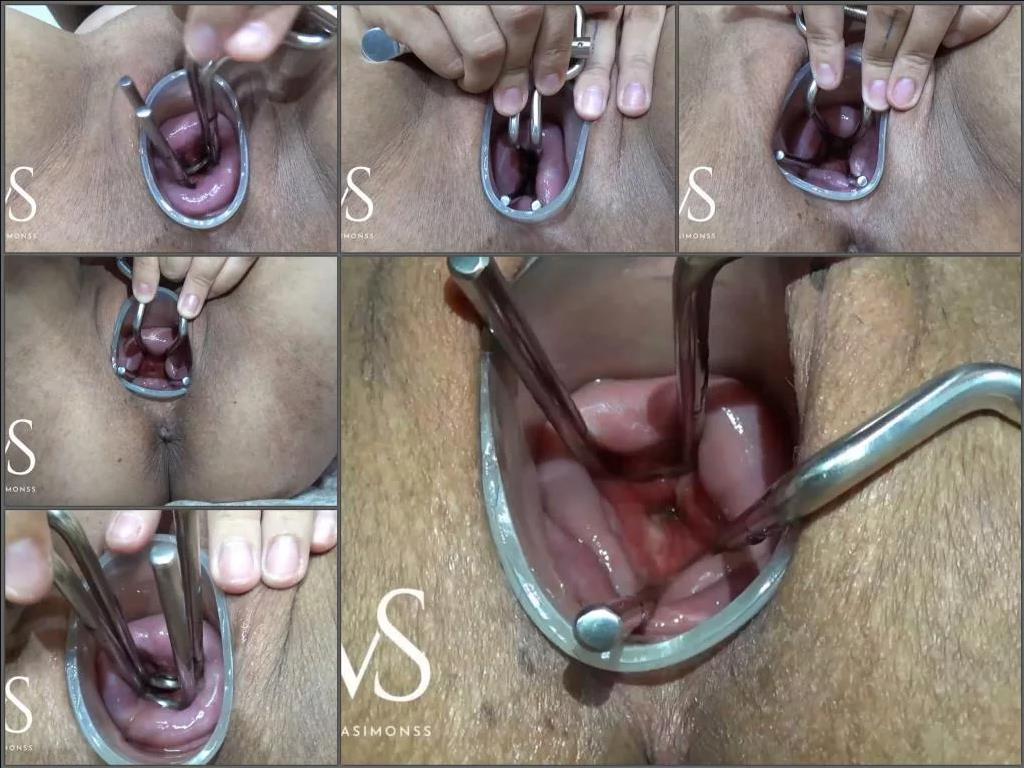 Speculum examination – MayaSimons opening her cervix with tunnel toy